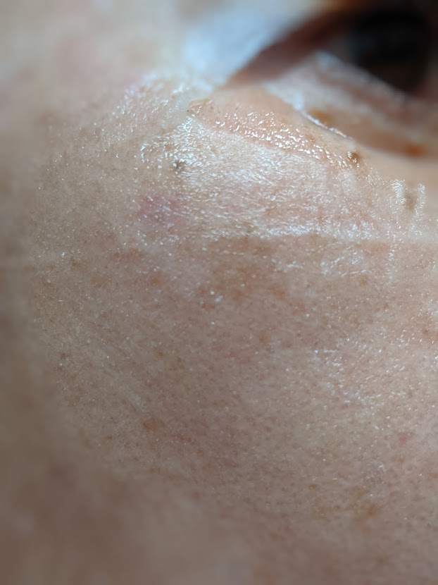 ヒアルロニックシート